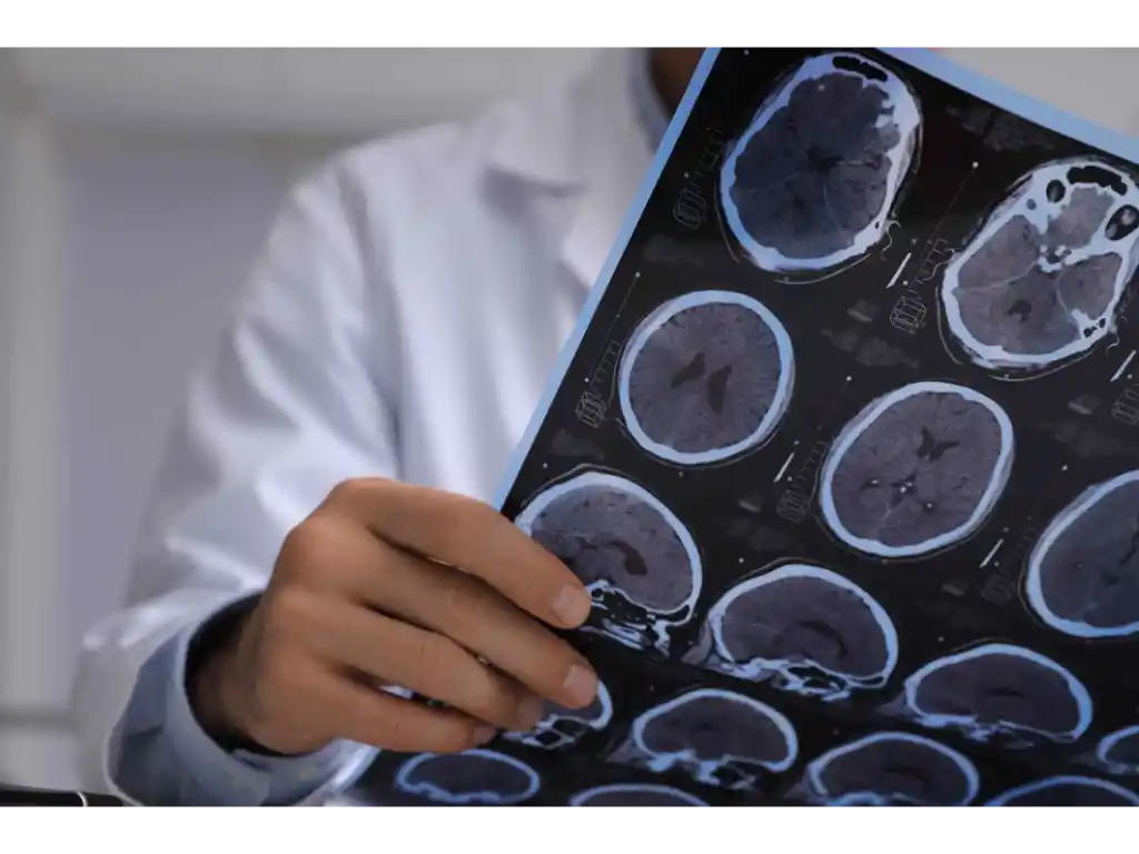 Shocking Facts About Traumatic Brain Injuries - Louisville | T: (502) 771-1529